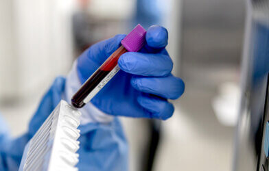 Close-up on a technician analyzing blood samples at the lab and holding a test tube