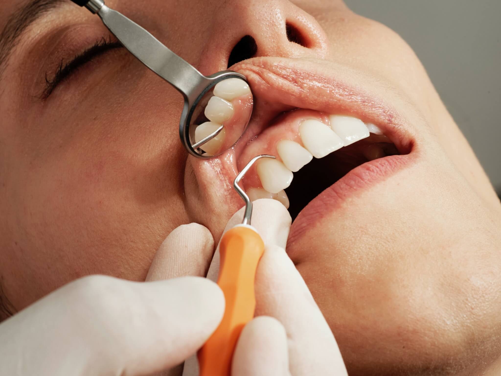 Dentist patient having teeth and gums examined