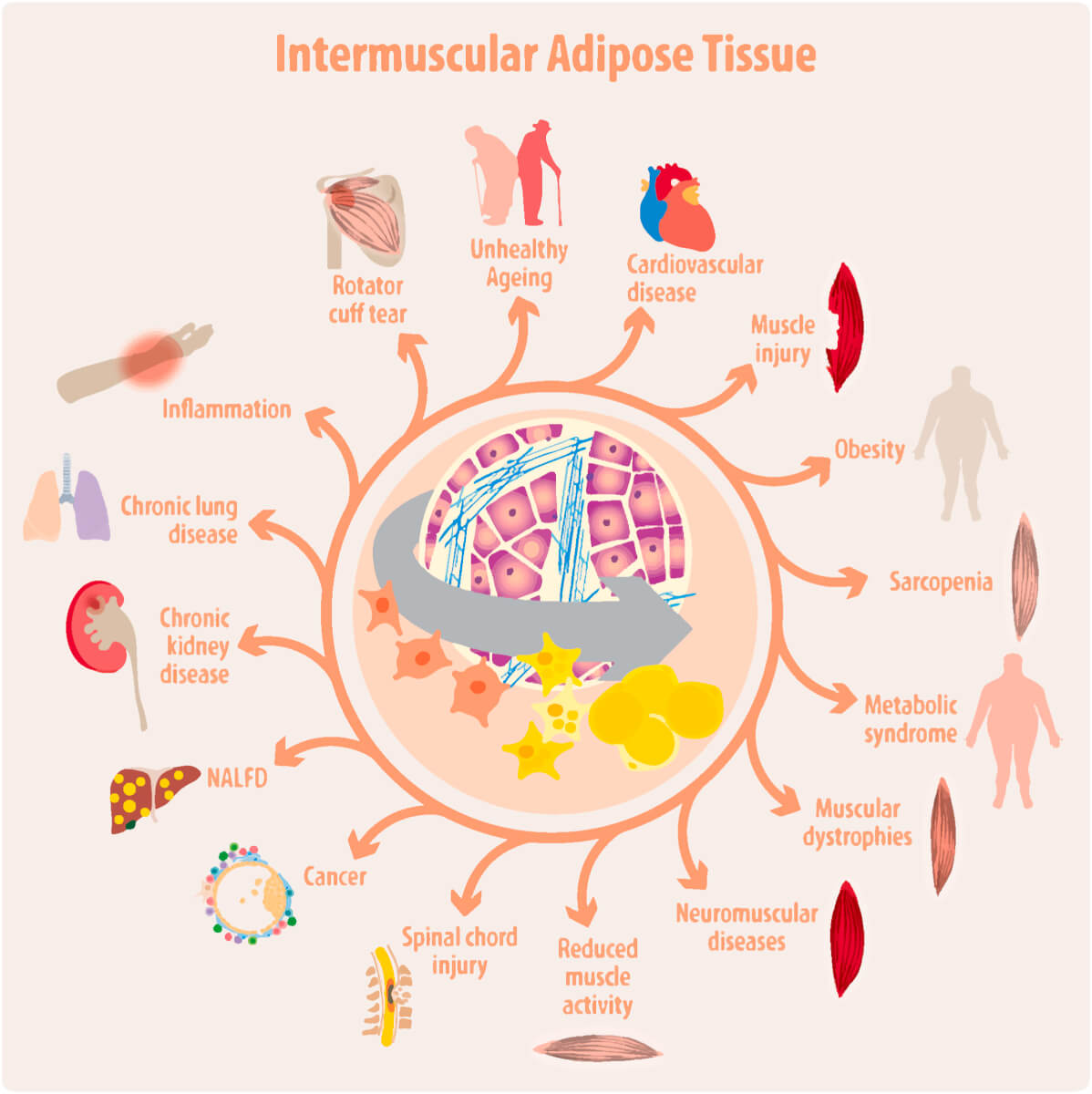 intermuscular fat tissue and connected diseases