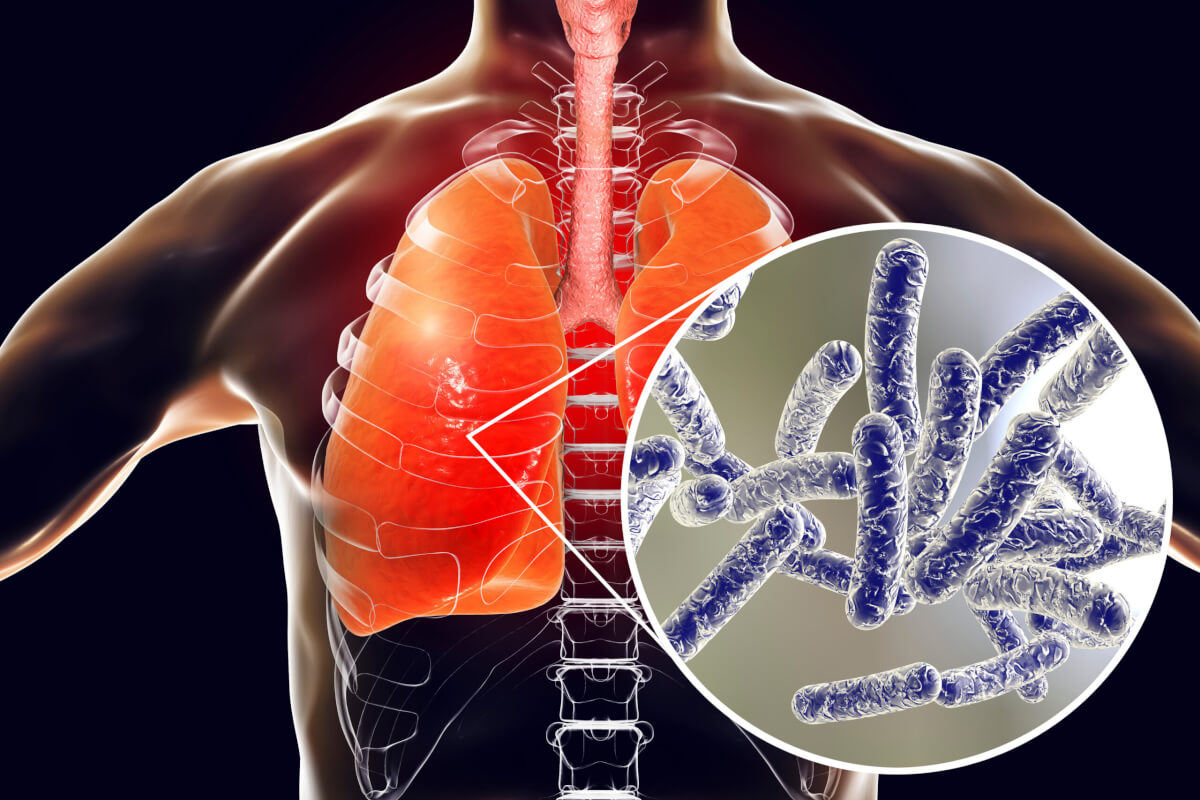 Legionella bacteria