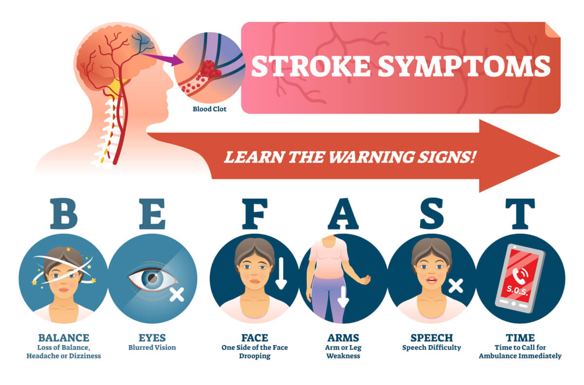 Stroke symptoms